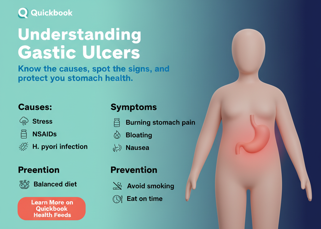 Gastric Ulcers – Causes, Symptoms, And Prevention
