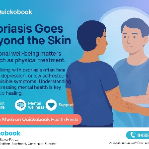 Psoriasis And Its Impact On Mental Health